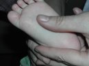 Las pies y las manos